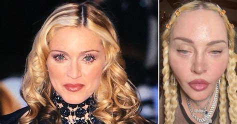 Did Madonna Get Plastic Surgery? Exploring the Myths and Realities of Celebrity Transformations