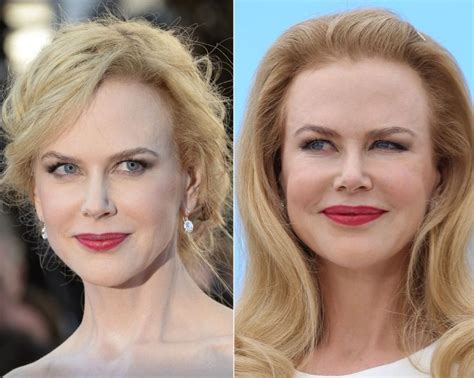 Did Nicole Kidman Get Plastic Surgery? Exploring the Facets of Celebrity Transformations